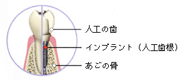�C���v�����g�̍\��